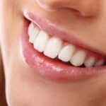 The Secret to a Radiant Smile: DIY Dental Care Hacks